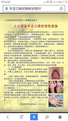 幼儿手足口病预防 之家长篇