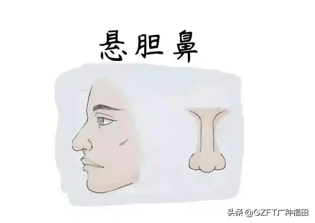 悬胆鼻