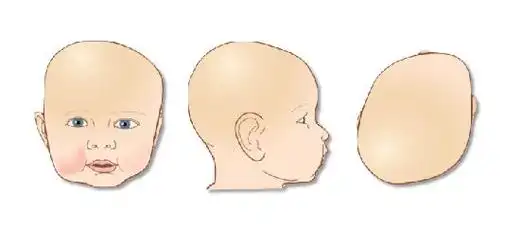 孩子的健康成长离不开家长的细心照料,那么在宝宝大脑高速发育的阶段