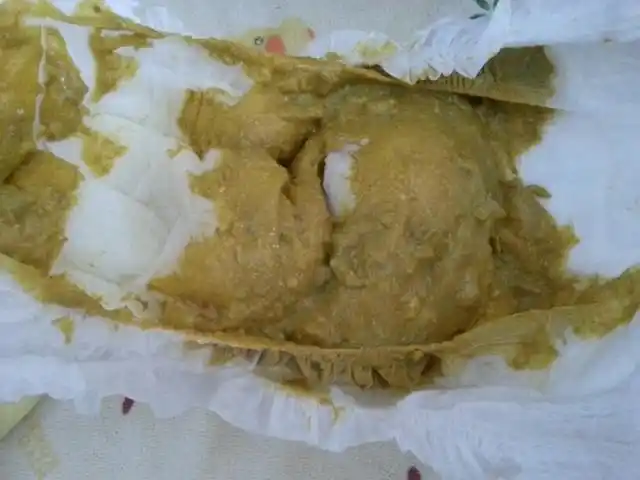 求助,十个月的宝宝还有拉稀的大便吗