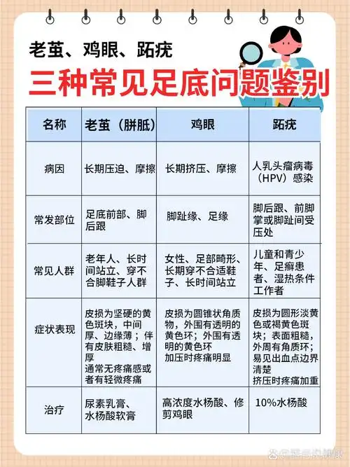 鉴别3种常见足底疾病:老茧,鸡眼,跖疣