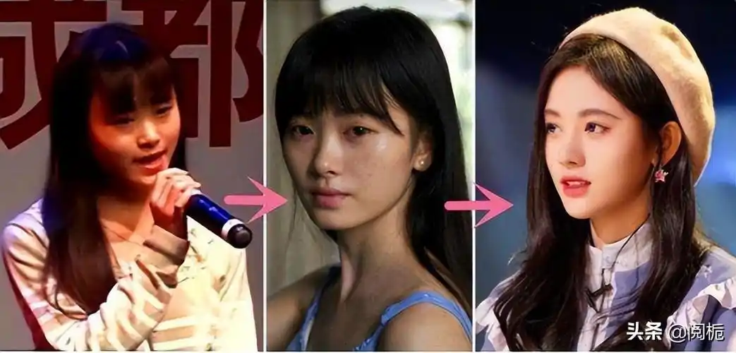 盘点9位整容女星有人换头改命成一线有人适得其反断前途
