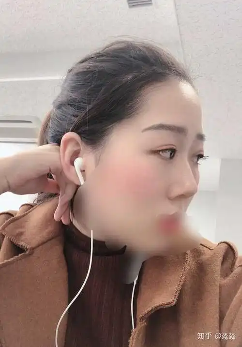 鼻子高但是山根低是什么样?