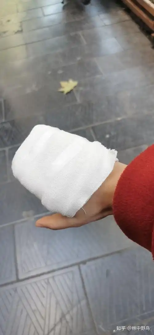 麻木过后真正的疼痛才降临