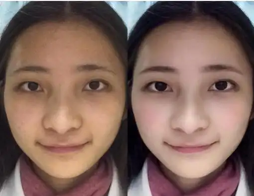 坚持跑步三个月脸部的变化对比