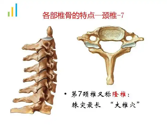design 各部椎骨的特点—颈椎-7   第7颈椎又称隆椎: 棘突最长 "大椎