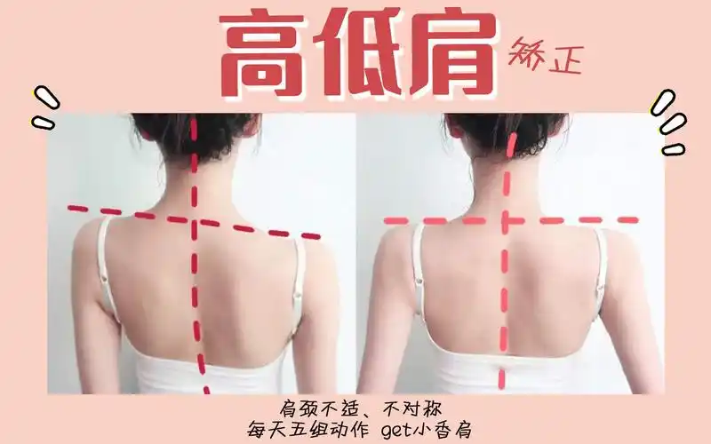 高低肩肩颈酸痛很难解决吗简单有效的动作在这里