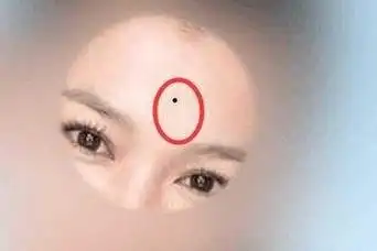 印堂善痣为双龙抢珠是成功之相