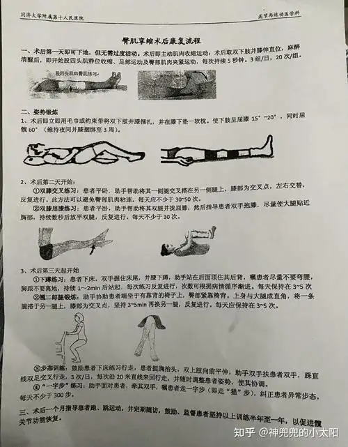 持续更新臀肌挛缩手术及恢复过程