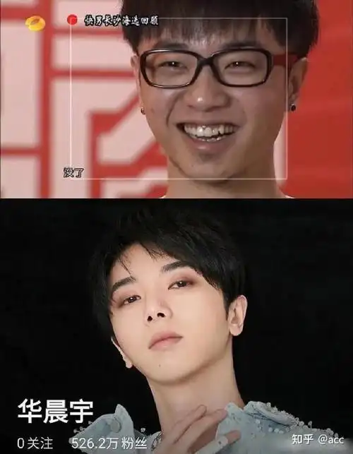 如何看待关于华晨宇整容的爆料?