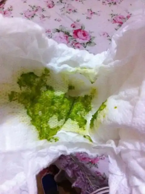 我家宝宝今天拉的粑粑是这个颜色的!