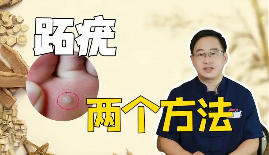 脚底跖疣,2个方法!
