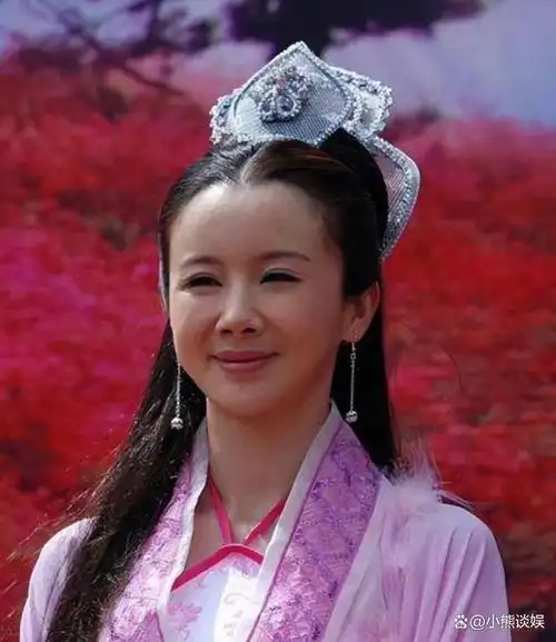 4位科技脸反面教材初见荧屏惊鸿一瞥再见整容颜垮不敢认