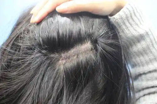 拔一根白发,会长出更多白发吗?_毛囊_头发_洗头