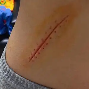 仿真疤痕贴手术缝针拆线后伤疤sen假伤口假皮特效化妆