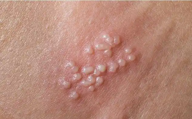 特别是有了同居伴侣的女性的身体健康状况跟男方也有很大关系,如果