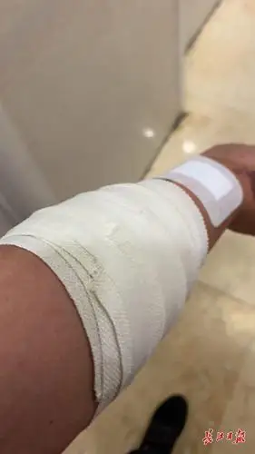 受伤民警杨齐峰,手臂已被包扎.警方供图