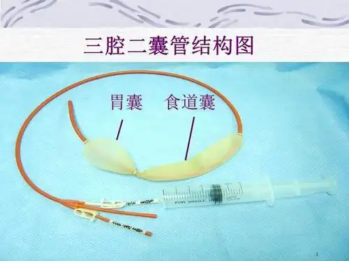 【ppt】三腔二囊管的应用及护理