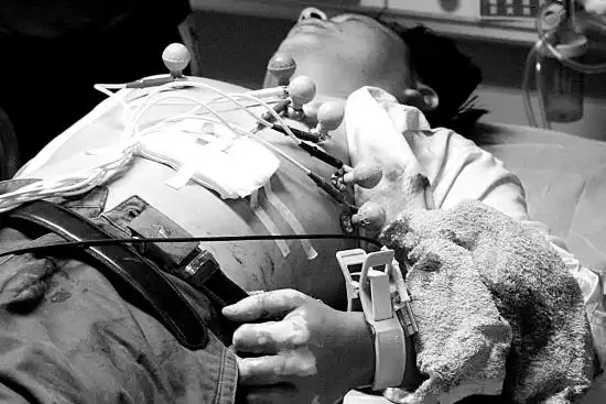 夏先生小腹被老婆刺中. 唐光峰 摄