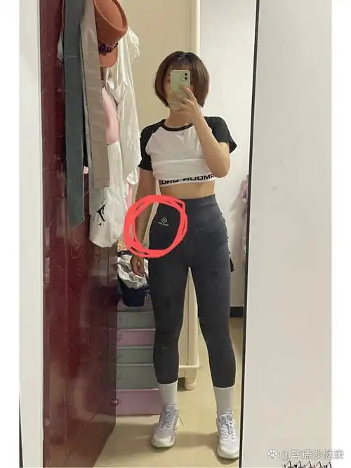 你们的胯骨也会突出来一块儿吗?