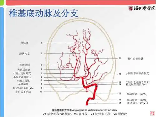 脑血管造影动脉解剖(读书报告)ppt