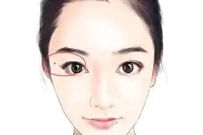 女人右眼凤尾痣说法右眼凤尾痣好不好