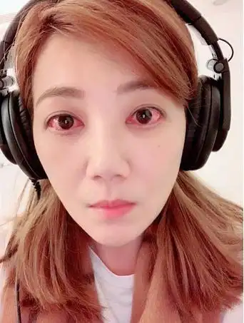 失恋哭红的眼睛图片,哭红眼的图片只有眼睛-图片大观-奇异网