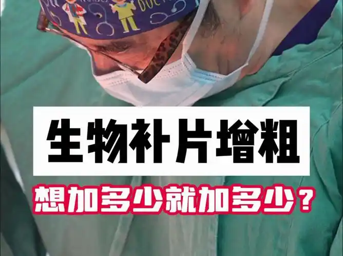 生物补片增粗 想加多少就加多少?