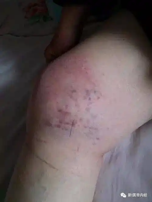 你的身上,有没有淤堵,看手臂就知道