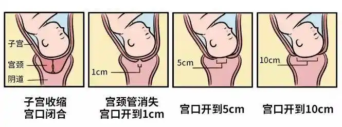 看懂"开十指",终于明白女人生孩子有多痛