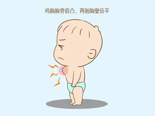 小孩子被检查出患有鸡胸让妈妈想起一件旧事羞愧的低下头