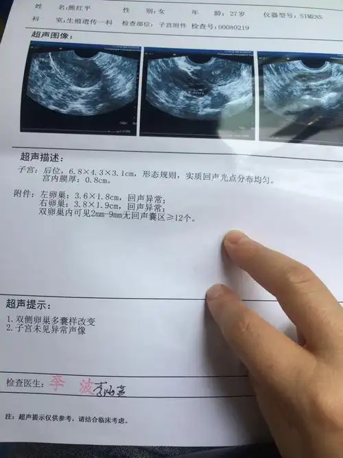 月经不调多年,结婚半年不孕.昨天到医院检查,拿到结果医生下班了.