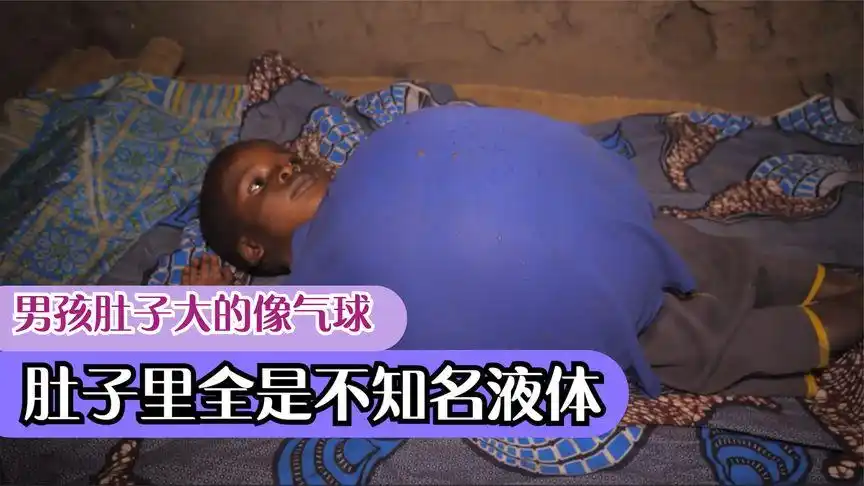 男孩肚子大的像气球,里面全是不知名液体,随时都有爆炸可能-影视综