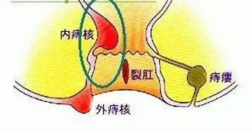 给人们带来了很大的危害,特别是女性痔疮患者更多,所以女性朋友们在