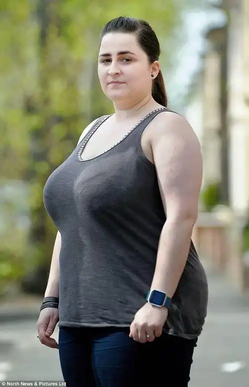 38g胸部挤压脊椎如果不减肥未来5年之内可能坐轮椅