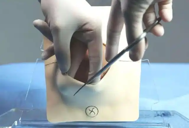 原创顺产侧切会影响夫妻生活吗产妇别害羞看看医生的说法