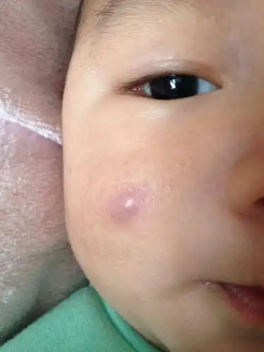 有遇到类似的吗求助