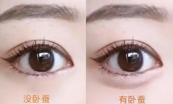 一般来说,有卧蚕的人会让人感觉到更加的有亲和力,笑起来有更大的魅力