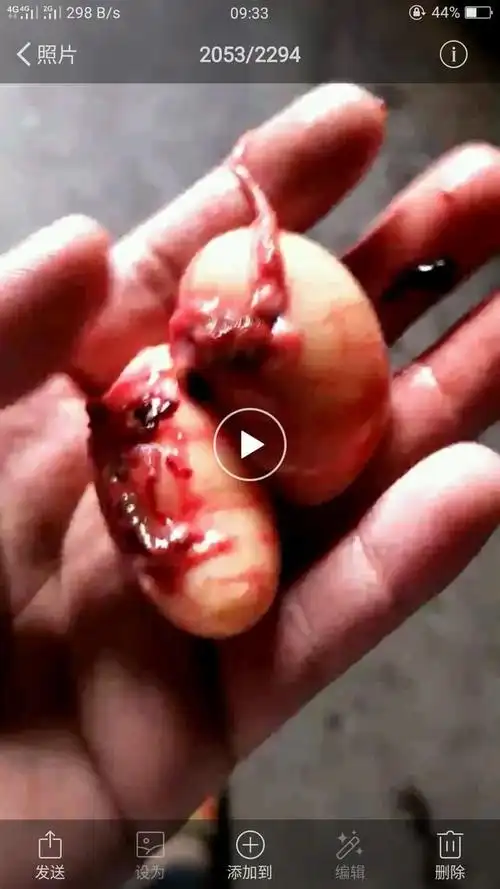 男生每隔五年要切一刀换一次蛋蛋吗? - 知乎