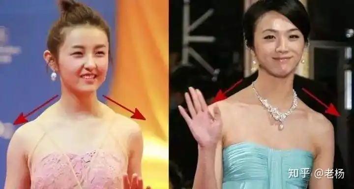 然而多数女生的斜方肌很明显,并非是因为锻炼出来的"肌肉发达",可能