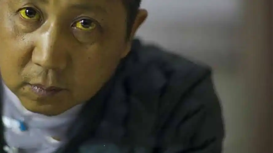 肝癌病人临死前会经历什么,究竟有多难受?看完一阵心疼