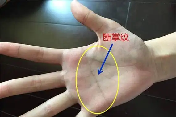 女儿断掌过房养"的说法,意思是,如果男士手上有断掌纹,预示着事业红火