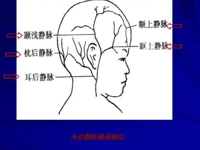 小儿头皮静脉穿刺技巧及特点