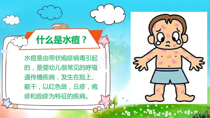 传染病防控宣传——预防水痘