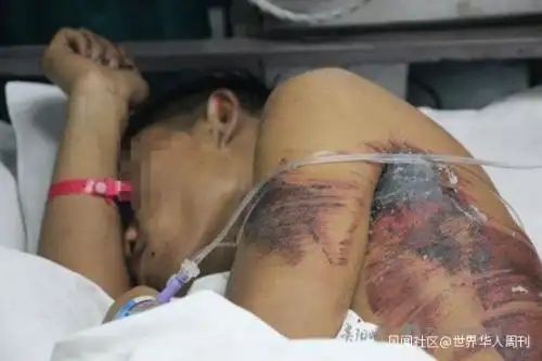 高速上新郎被撞飞中国式闹婚什么时候才能停止