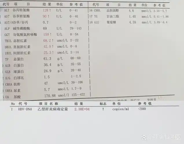 乙肝患者出现这种情况一定要及时抗病毒治疗,处于免疫