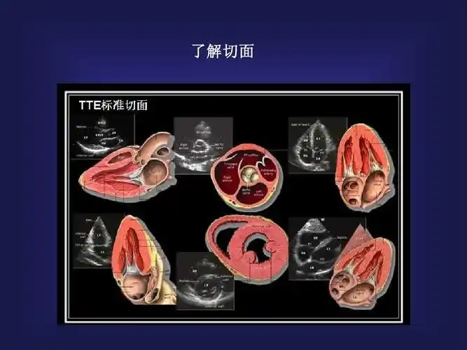 心动图报告ppt 第4页 (共24页,当前第4页) 你可能喜欢 心脏超声课件