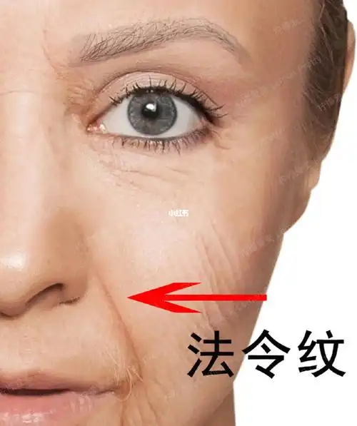 法令纹 鱼尾纹的出现也可能是你睡势出错了