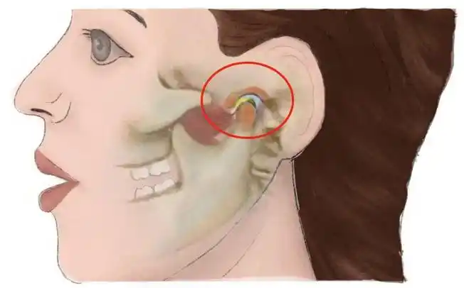 网友谈颞下颌关节紊乱丨什么是颞下颌关节紊乱病