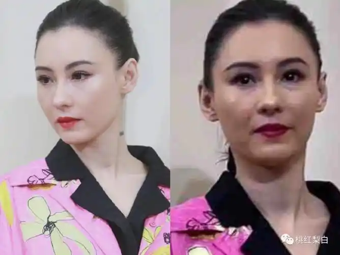 张柏芝这张脸,怎么僵成这样了?